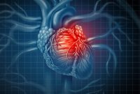 درمان فشار خون؛ معضلی برای نارسایی‌ قلبی که در کلینیک تخصصی قلب و فشار تپش درمان می‌شود
