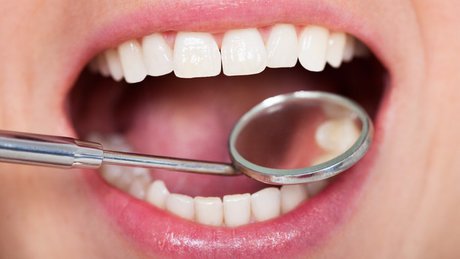 چگونه مینای دندان خود را ترمیم کنیم ؟
