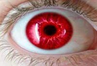 کمیاب‌ترین «رنگ چشم» جهان؟