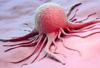 بیماری سرطان ریشه کن می شود